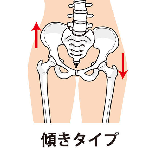 傾きタイプ