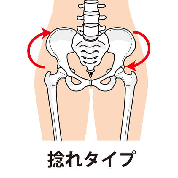 ねじれタイプ