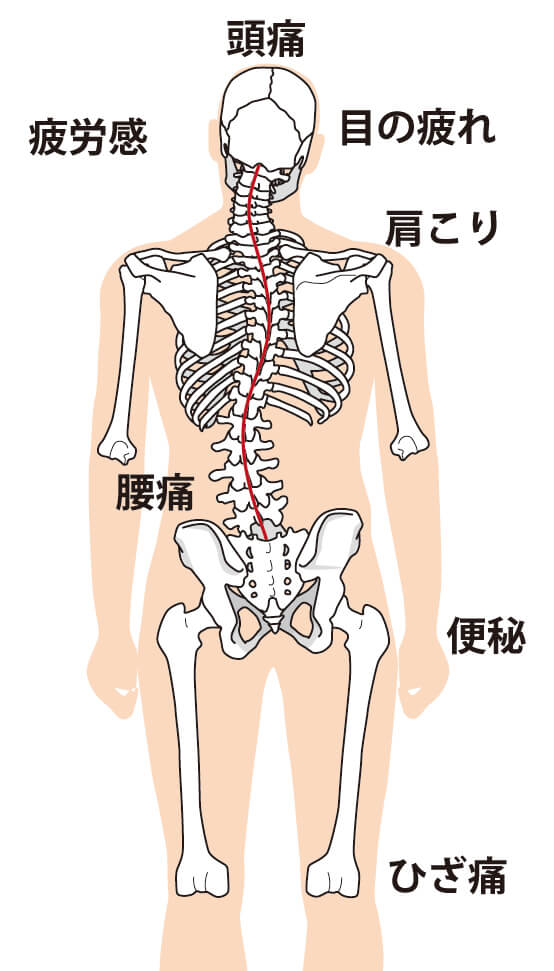 骨格